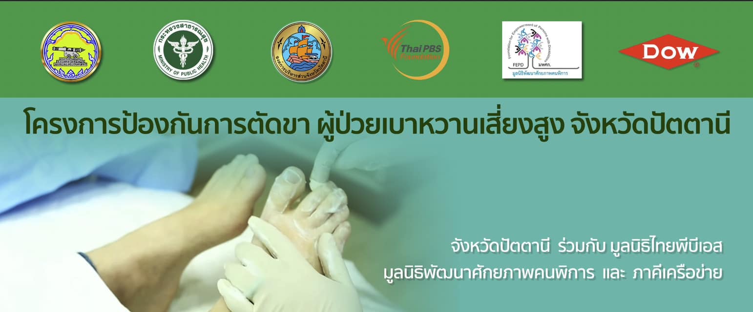 สนับสนุนจัดทำ “โครงการป้องกันการตัดเท้าผู้ป่วยเบาหวาน: รองเท้าพิเศษเฉพาะบุคคล” 